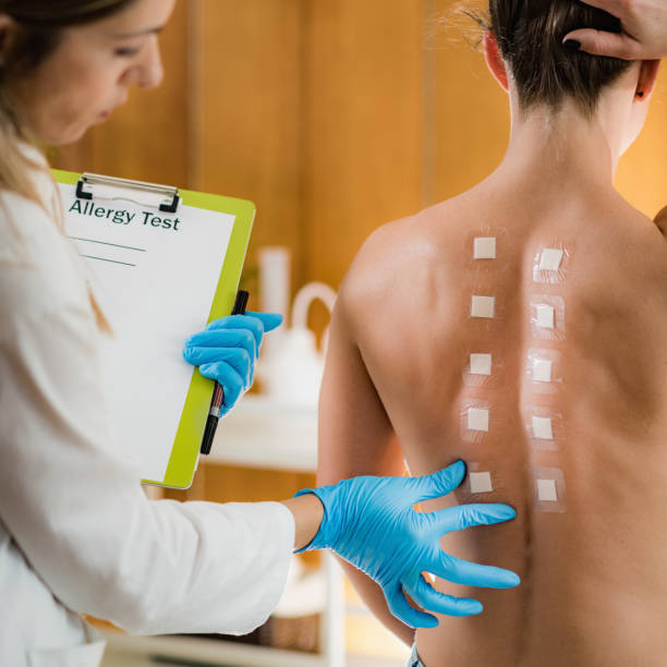 doctor doing skin allergy test - allergologe stock-fotos und bilder