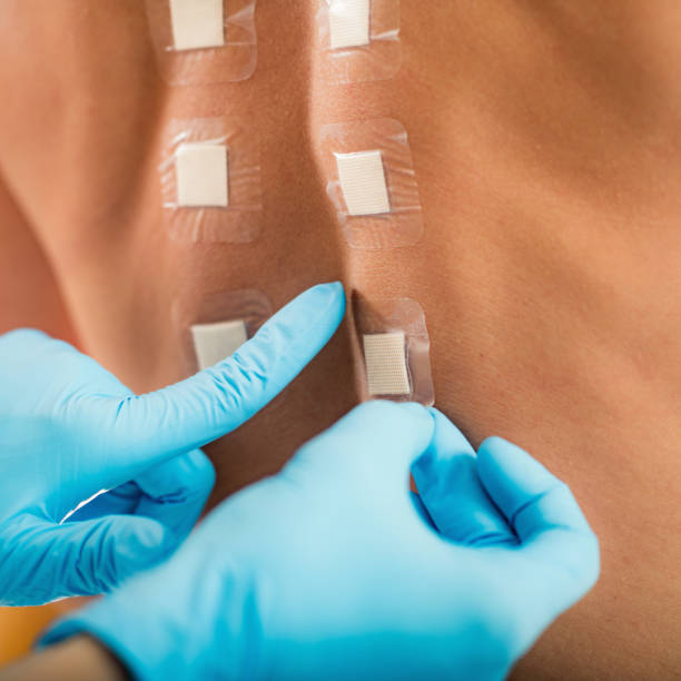 istock Doctor Doing Skin Allergy Test 1167050282
