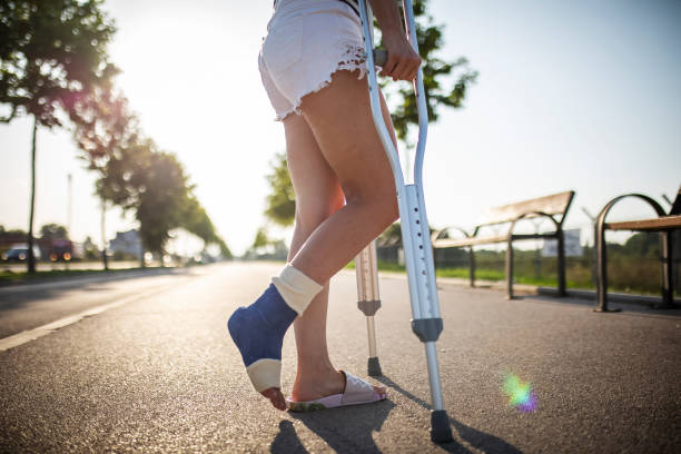 młoda kobieta ze złamaną nogą ciesząc się w słoneczny letni dzień - brzask ranny zdjęcia i obrazy z banku zdjęć