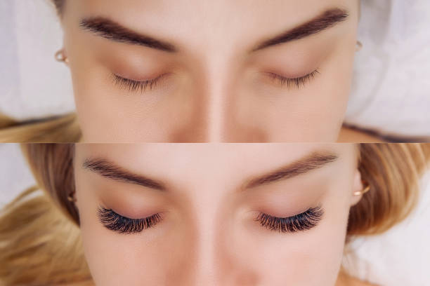 istock Eyelash Extension. Comparison of female eyes before and after 1167389653