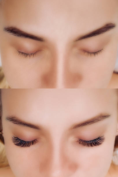 istock Eyelash Extension. Comparison of female eyes before and after 1167389733
