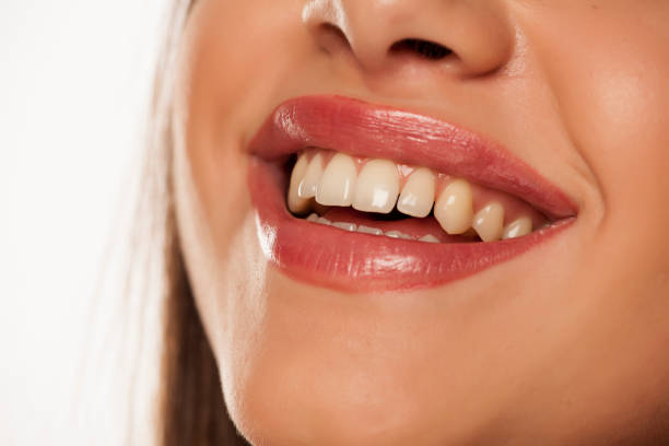 istock Smiling woman with natural and healthy teeth 1167542721