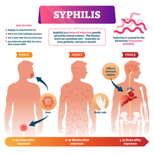Sifilis Vectores Libres de Derechos - iStock