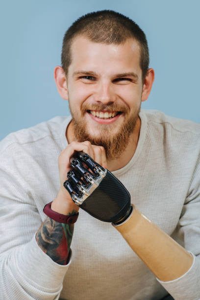istock Young Man With Artificial hand is looking forward and smiling at the camera 1167581210