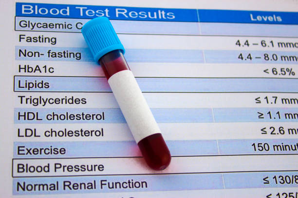 prueba de colesterol y tubo de análisis de sangre - lipoprotein fotografías e imágenes de stock