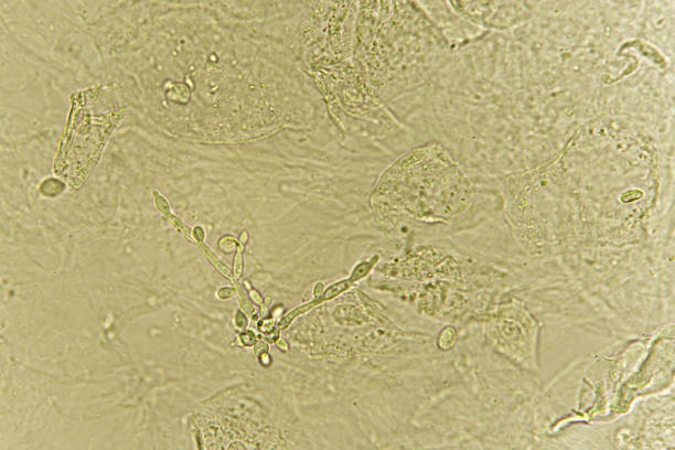 istock Pseudohyphae and budding yeast cells in patient urine 1168014654