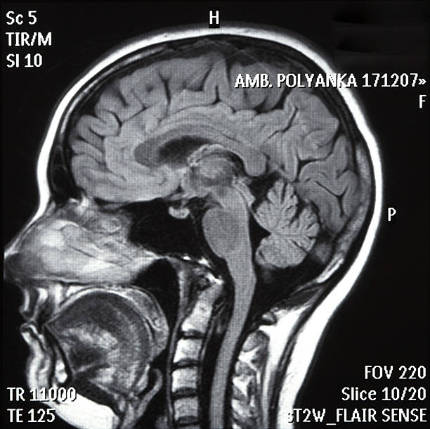 x-ray imagem de um cérebro - brain mri scanner mri scan medical scan imagens e fotografias de stock