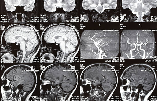 x-ray imagem de um cérebro - medical equipment mri scanner mri scan hospital - fotografias e filmes do acervo