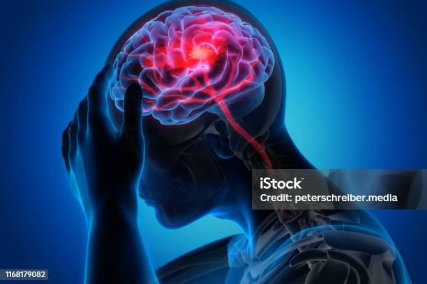 Man With Brain Stroke Symptoms Stock Photo - Download Image Now - Stroke - Illness, Headache, Human Nervous System