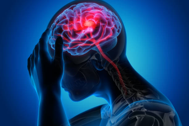 man with brain stroke symptoms - dor de cabeça ilustrações imagens e fotografias de stock