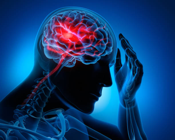 脳卒中の症状を持つ男性 - human nervous system 写真 ストックフォトと画像