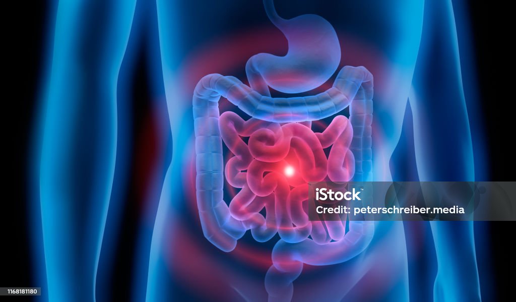 Body with stomach and colon problem Medical Illustration of colon problems Intestine Stock Photo