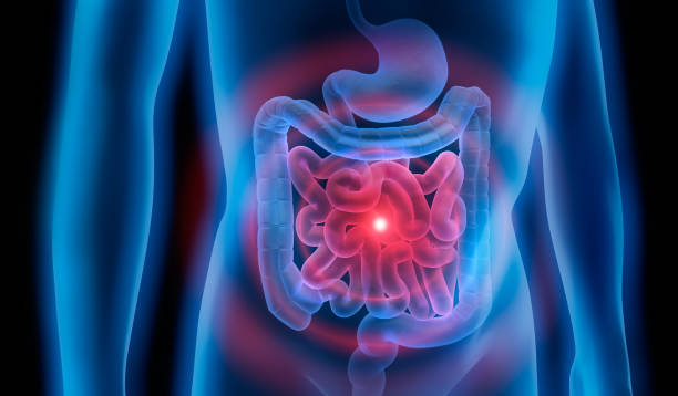 Body with stomach and colon problem Medical Illustration of colon problems colon photos stock pictures, royalty-free photos & images