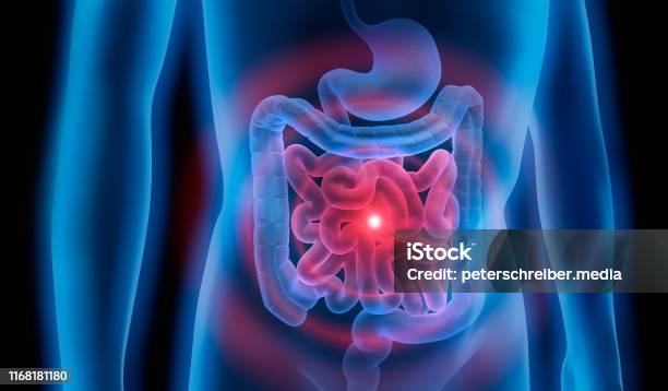 Body With Stomach And Colon Problem Stock Photo - Download Image Now - Intestine, Abdomen, Colon