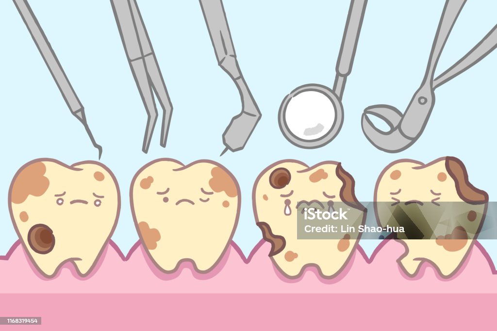 Cartoon Tooth Decay With Tools Stock Illustration - Download Image Now -  Dental Cavity, Rotting, Sharp - iStock