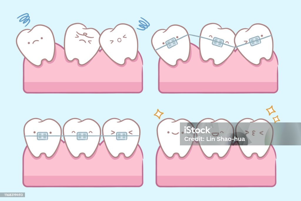 Cartoon Tooth With Dental Care Stock Illustration - Download Image Now - Dental  Braces, Teeth, Orthodontist - iStock