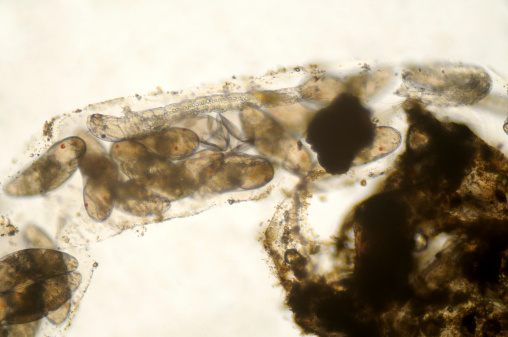 Photomicrograph of midge fly, Chironomidae family, eggs hatching. Eggs are encased in a gelatinous material that attracts debris. Live specimen. Larva about 0.5 mm long. Wet mount, 10X objective, transmitted brightfield illumination.