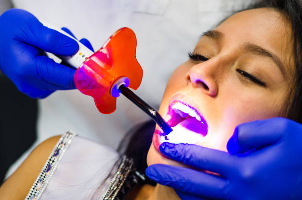 close-up portrait of a female patient visiting dentist for teeth whitening - dental light dental equipment hospital professional occupation imagens e fotografias de stock