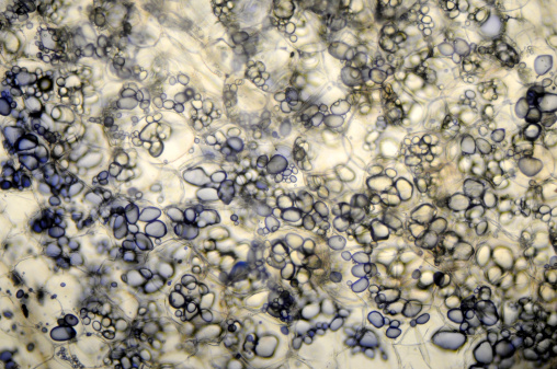 potato starch micrograph