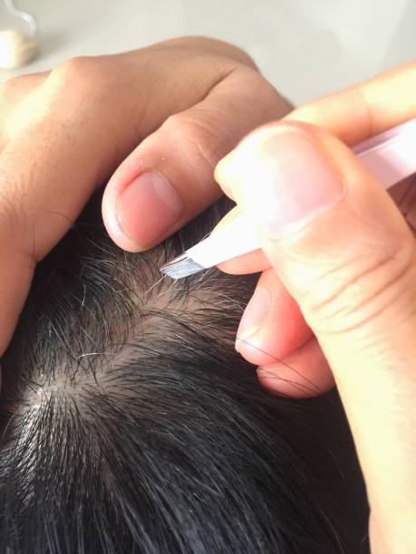 istock Close up removing gray hair 1168552627
