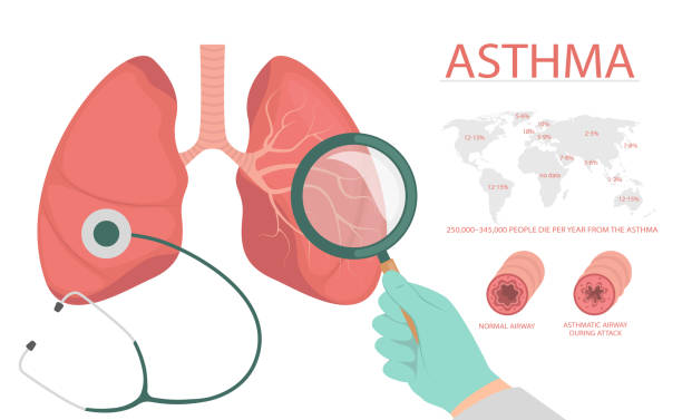 asthma Detail about of asthma symptoms and causes have man. Medical education chart of biology for lungs diagram. Vector illustration in flat style for medical atlases, articles, infographics. clip art of a diagram of human lungs stock illustrations