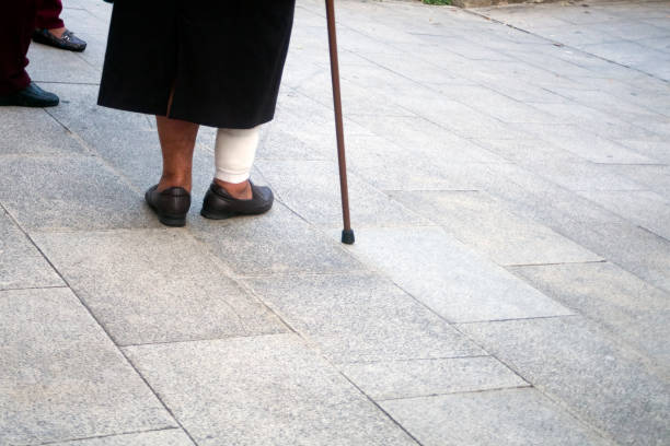 senior woman with walking cane and leg bandage - garment fragility women skirt imagens e fotografias de stock