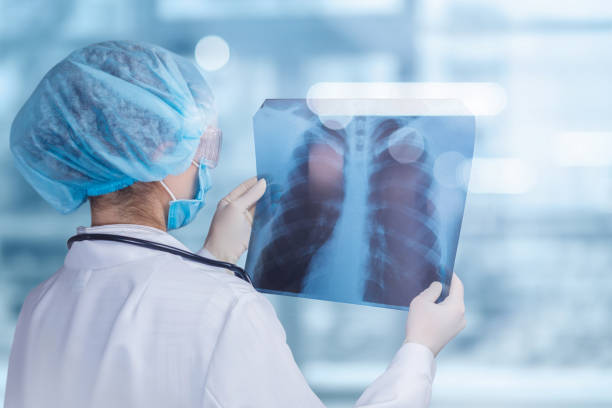 istock Doctor looking image of the lungs . 1168665400