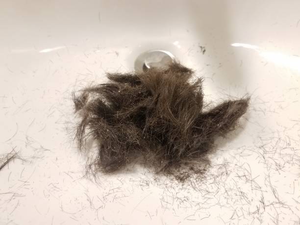 istock shaved brown hair with dandruff in white sink 1168667913