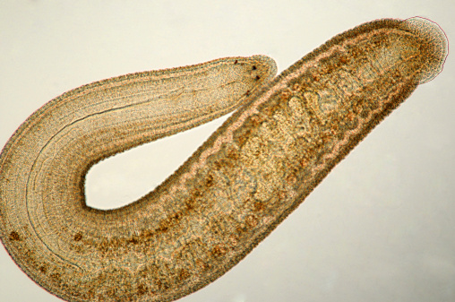 Photomicrograph of newly hatched freshwater leech. Note multiple eyes at head and second attachment sucker at tail. Body length approx. 3 mm. Live specimen. Wet mount, 5X objective, transmitted brightfield illumination.