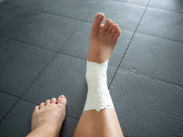 istock Perspective of an athlete looking at her taped ankle sprain 1168783230