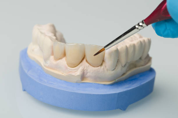 istock Dental imprint with artificial dentition and tools in a dental laboratory 1168968001