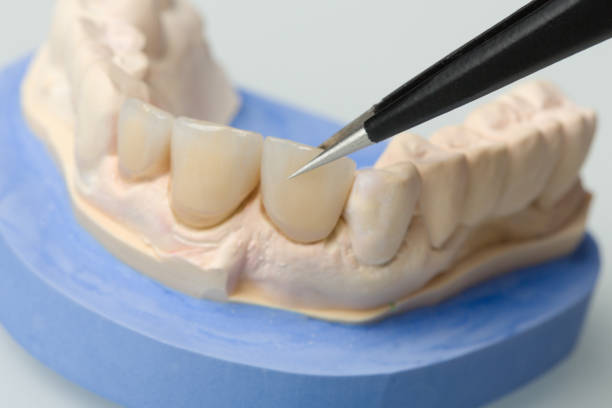 istock Dental imprint with artificial dentition and tweezers in a dental laboratory 1168968024