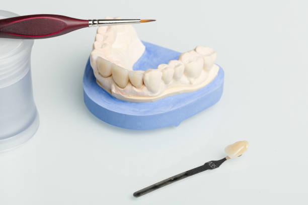 istock Dental imprint with artificial dentition and painting tools in a dental laboratory 1168968050