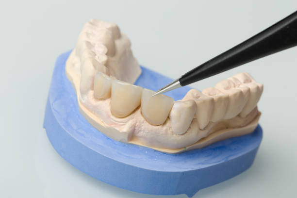 istock work on artificial dentition with  a tweezer in a dental laboratory 1168968066