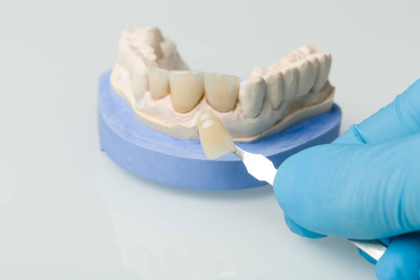 istock Dental imprint with artificial dentition and tools in a dental laboratory 1168968067