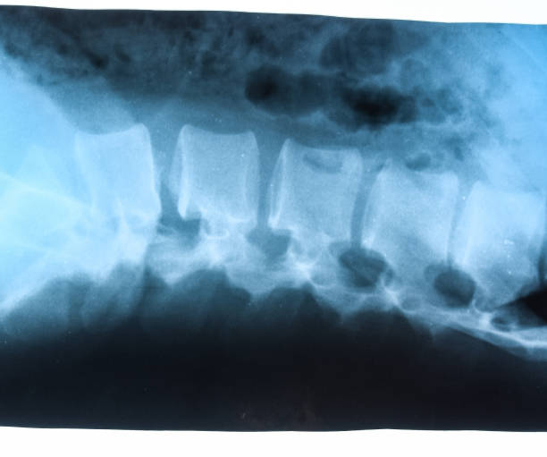 röntgenaufnahme der lendenwirbelsäule, wirbelsäule auf röntgen - haunch stock-fotos und bilder