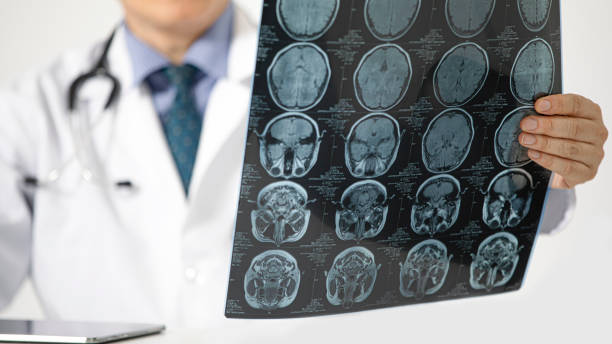 istock A doctor examing a MRI scan. 1169139868