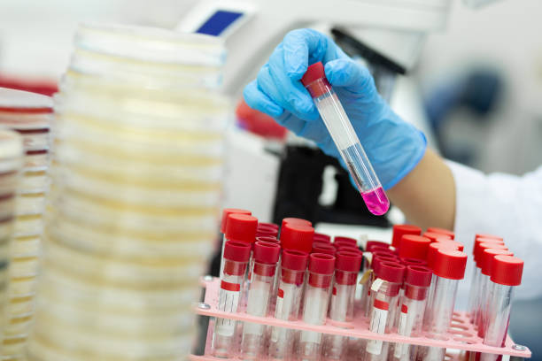 istock Focused photo on female hand that checking reagent 1169293080