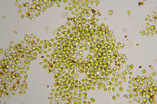 Photomicrograph of a freshwater clustering single-celled green algae, 