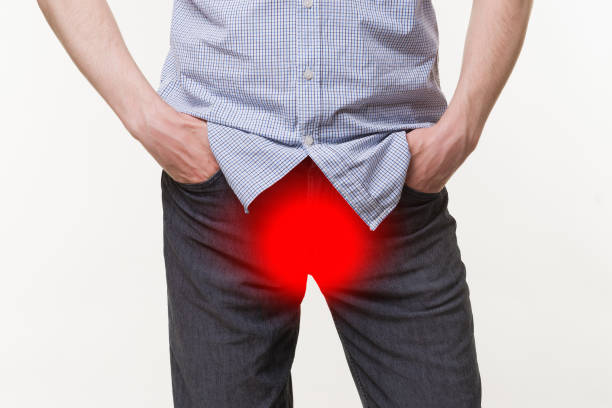 pain in prostate, man suffering from prostatitis or from a venereal disease - venereal imagens e fotografias de stock