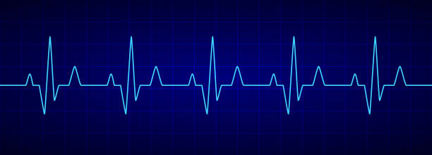 istock Heartbeat line. Blue cardiogram. Electrocardiogram. Vector illustration. 1169325125