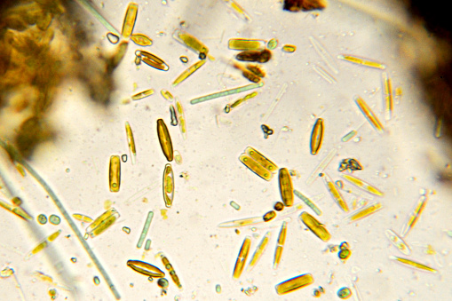 Diatoms occur in a variety of shapes. Each diatom is composed of one cell in a clear silica outer wall and is mobile. Each shape is a different species. A few filaments of cyanobacteria are also present. Freshwater. Live specimen. Wet mount, 40X objective, transmitted brightfield illumination.