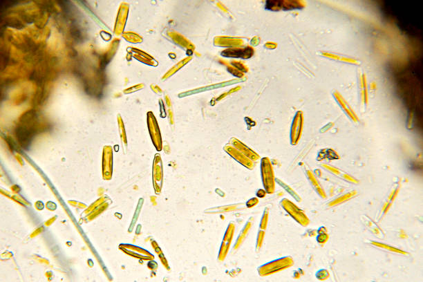 diatoms micrograph Diatoms occur in a variety of shapes. Each diatom is composed of one cell in a clear silica outer wall and is mobile. Each shape is a different species. A few filaments of cyanobacteria are also present. Freshwater. Live specimen. Wet mount, 40X objective, transmitted brightfield illumination. light micrograph photos stock pictures, royalty-free photos & images