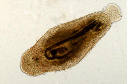 Egg of intestinal fluke in human stool, analyze by microscope, original magnification 400x