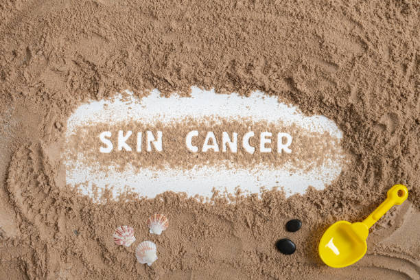 The word skin cancer is stencilled in block letters into the sand. There is some small rocks and shells surrounding the word. To the right of the skin cancer lettering is a yellow spade. This is an overhead shot.