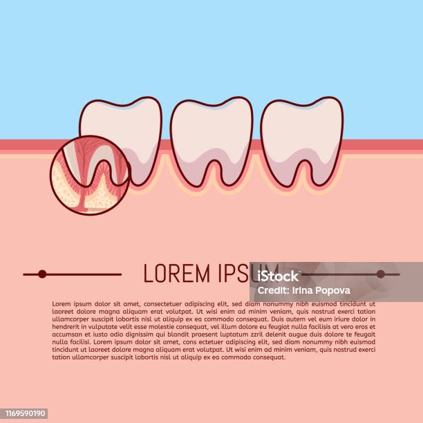 Inside Line For Tooth Layout Crosssection Structure Inside Tooth Illustration Vector On Blue ...