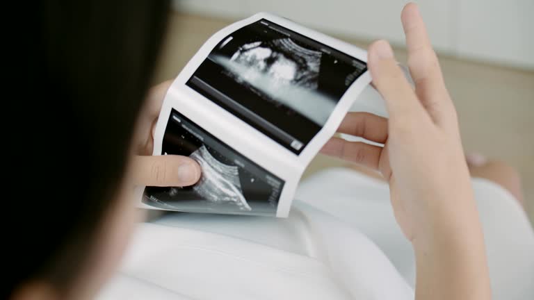17,000+ Ultrasound Stock Videos and Royalty-Free Footage - iStock