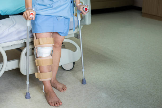 pacjent stojący o kulach w szpitalu ware wsparcia klamry kolana po operacji więzadła krzyżowego tylnego, bandaż na kolanie azjatki na kulach.healthcare i koncepcji medycznej. - cruciate ligament zdjęcia i obrazy z banku zdjęć