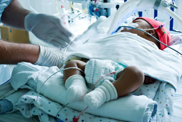 병원 소아 중환자실의 인공호흡기에 걸린 중증 아픈 아기를 돌보는 의사 - 신생아 병동 뉴스 사진 이미지