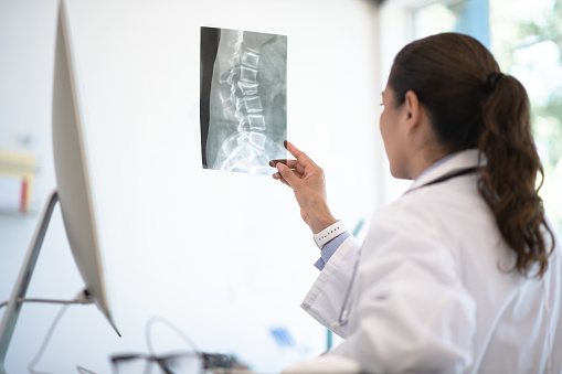 A hispanic doctor looks inquisitively at an x-ray image while sitting at her modern desk. She's looking at an image of a spine.